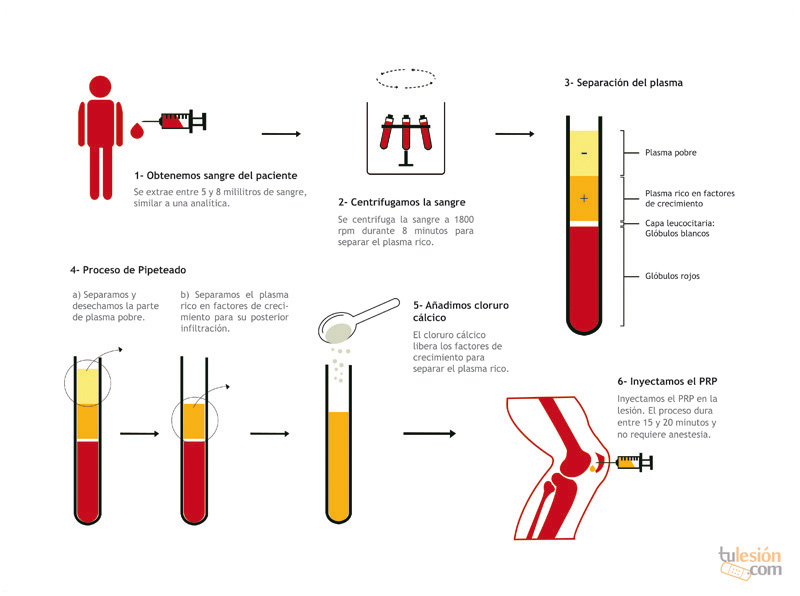 Rehabilitación con magnetoterapia en Clínicas Beiman - Clínica Beiman -  Jerez - Granada - Sevilla - Las Cabezas- Córdoba - Jaén